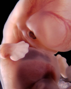 embryo, 44 days, Carnegie stage 18